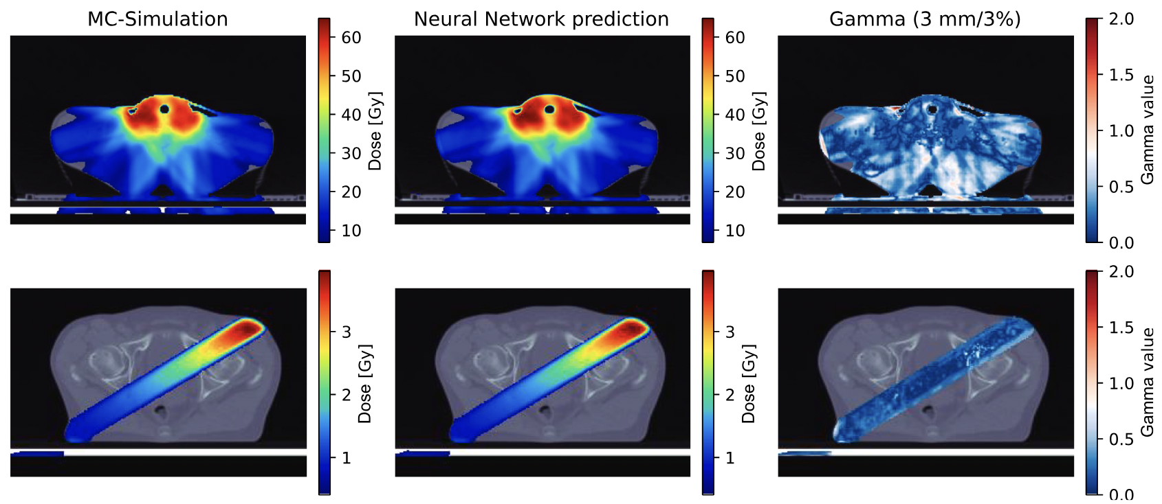 Development and comprehensive clinical validation of a deep neural network for radiation dose modelling to enhance magnetic resonance imaging guided radiotherapy